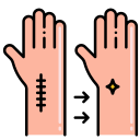 Eliminacion de Tatuajes en Los Angeles